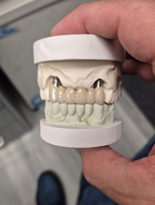 JC's Dental Designs - Mesa, Arizona