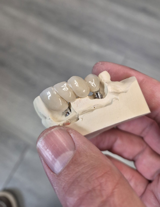 JC's Dental Designs - Mesa, Arizona