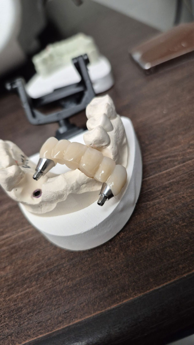 JC's Dental Designs - Mesa, Arizona