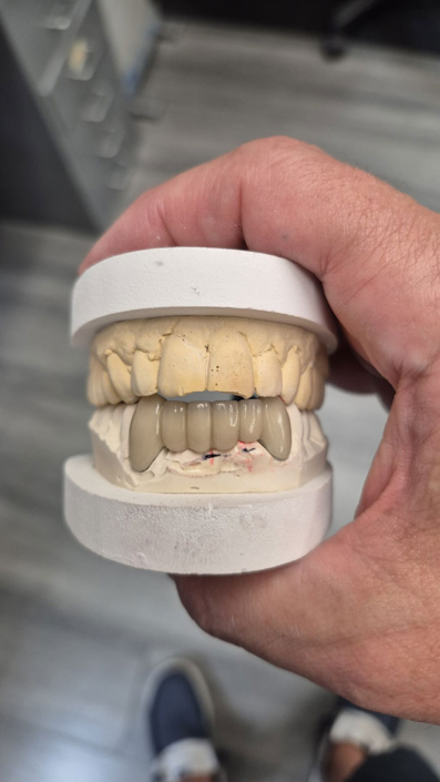 JC's Dental Designs - Mesa, Arizona