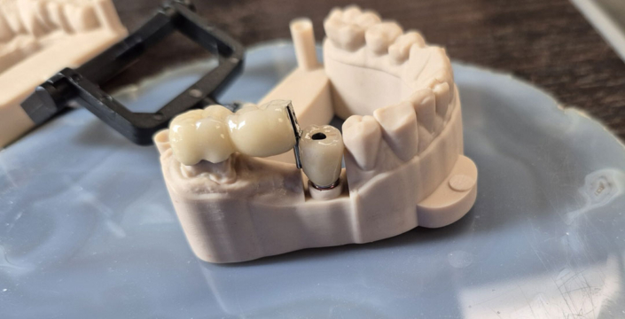 JC's Dental Designs - Mesa, Arizona