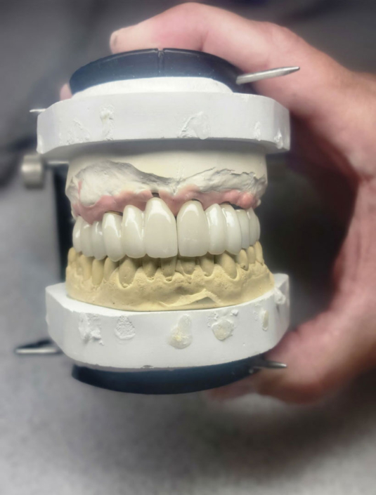 JC's Dental Designs - Mesa, Arizona